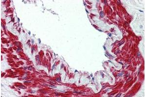 Anti-TRPM8 antibody  ABIN960829 IHC staining of human lung, vessel. (TRPM8 Antikörper  (N-Term))