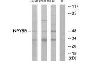 Western blot analysis of extracts from COLO/Jurkat/HepG2 cells, using NPY5R Antibody. (NPY5R Antikörper  (AA 221-270))
