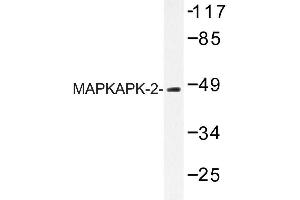 Image no. 1 for anti-Mitogen-Activated Protein Kinase-Activated Protein Kinase 2 (MAPKAPK2) antibody (ABIN272118) (MAPKAP Kinase 2 Antikörper)