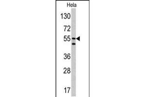 Western blot analysis of CA9 antibody in Hela cell line lysates (35ug/lane) (CA9 Antikörper  (AA 113-143))