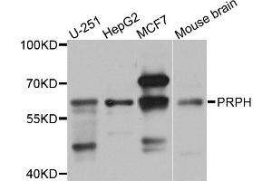 Western blot analysis of extracts of various cell lines, using PRPH antibody (ABIN5972212) at 1/1000 dilution. (Peripherin Antikörper)