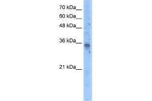 WB Suggested Anti-SLC25A16 Antibody Titration:  5.