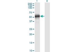 Western Blotting (WB) image for anti-Fibulin 4 (FBLN4) (AA 26-443) antibody (ABIN2752208)
