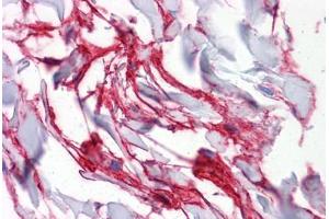 Human Colon, connective tissue: Formalin-Fixed, Paraffin-Embedded (FFPE) (Aquaporin 8 Antikörper  (AA 1-255))