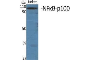Western Blot (WB) analysis of specific cells using NFkappaB-p100 Polyclonal Antibody. (NFKB2 Antikörper  (Thr160))