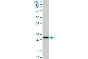 Western Blotting (WB) image for anti-Ribosomal Protein S5 (RPS5) (AA 106-204) antibody (ABIN519884)