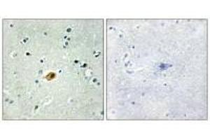Immunohistochemistry analysis of paraffin-embedded human brain tissue using SOX8/9/17/18 antibody. (SOX8 Antikörper  (C-Term))
