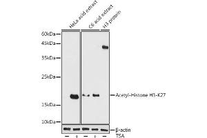 Western blot analysis of extracts of various cell lines, using Acetyl-Histone H3-K27 antibody (ABIN7267738) at 1:1000 dilution. (Histone H4 Antikörper  (H3K27))