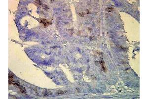 Immunohistochemistry analysis using Mouse Anti-Hsp70 Monoclonal Antibody, Clone BB70 . (HSP70/HSC70 Antikörper  (Atto 390))