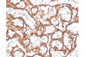 Formalin-fixed, paraffin-embedded human placenta stained with HCG-beta Rabbit Recombinant Monoclonal Antibody (HCGa/2728R).