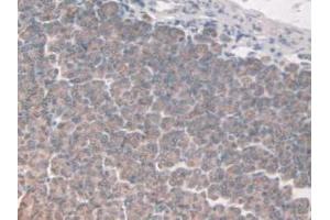 IHC-P analysis of Mouse Stomach Tissue, with DAB staining. (FAP Antikörper  (AA 542-761))