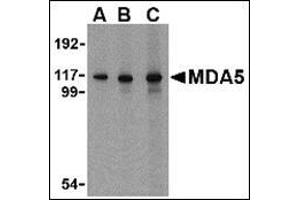 Western blot analysis of MDA5 in Daudi cell lysate with AP30553PU-N MDA5 antibody at 1 µg/ml (A), 2 µg/ml (B) and 4 μg/ml (C). (IFIH1 Antikörper  (C-Term))