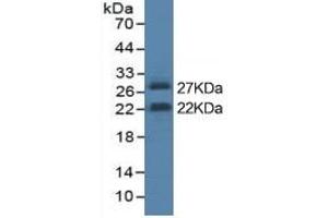 Rabbit Detection antibody from the kit in WB with Positive Control: Sample Cell culture supernatant of 293F cell which transfected with mouse IL6 gene.