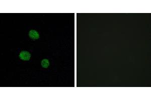 Peptide - +Immunofluorescence analysis of MCF-7 cells, using hnRNP M antibody. (HNRNPM Antikörper)