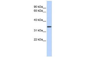 CCDC90A antibody used at 1 ug/ml to detect target protein. (CCDC90A Antikörper  (Middle Region))