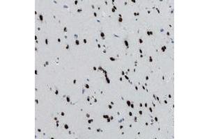 Immunohistochemical staining of human cerebral cortex with TTC13 polyclonal antibody  shows strong nuclear positivity in neurons at 1:20-1:50 dilution. (TTC13 Antikörper)