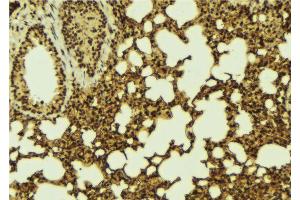 ABIN6267096 at 1/100 staining Mouse lung tissue by IHC-P.