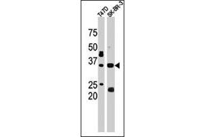 The ICMT polyclonal antibody  is used in Western blot to detect ICMT in T-47D (left) and SK-BR-3 (right) cell lysates.