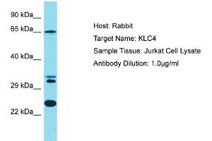 Host: Rabbit Target Name: KLC4 Sample Tissue: Human Jurkat Whole Cell Antibody Dilution: 1ug/ml (KLC4 Antikörper  (N-Term))