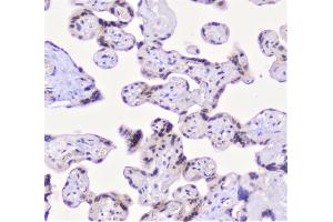 IHC analysis of CFP using anti-CFP antibody (ABIN6719298). (CFP Antikörper)