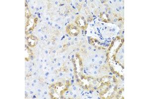 Immunohistochemistry of paraffin-embedded rat kidney using CGB7 antibody (ABIN5974696) at dilution of 1/100 (40x lens). (CGB7 Antikörper)