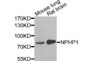 Western blot analysis of extracts of various cells, using NPHP1 antibody.