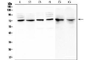 Western blot analysis of MUC20 using anti-MUC20 antibody (ABIN6719588).