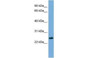 WB Suggested Anti-C6orf94 Antibody Titration:  0. (FAM164B Antikörper  (N-Term))