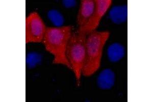 Immunofluorescent analysis of His-tag staining in 293T cells transfected with a His-tag protein. (His Tag Antikörper)