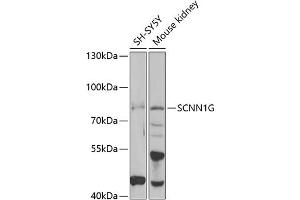 Western blot analysis of extracts of various cell lines, using SCNN1G antibody (ABIN6129468, ABIN6147453, ABIN6147454 and ABIN6221724) at 1:1000 dilution. (SCNN1G Antikörper  (AA 85-355))