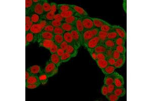 Immunofluorescence Analysis of human MCF-7 cells labeling CHP2 with CHP2 Mouse Monoclonal Antibody (CPTC-CHP2-1) followed by Goat anti-Mouse IgG-CF488 (Green). (Chp2 Antikörper)