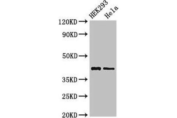 GALK1 anticorps  (AA 23-164)