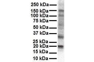 WB Suggested Anti-KCNAB2 antibody Titration: 1 ug/mL Sample Type: Human HepG2 (KCNAB2 Antikörper  (Middle Region))
