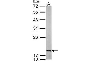 WB Image Sample (50 ug of whole cell lysate) A: mouse brain 12% SDS PAGE antibody diluted at 1:1000 (LMO1 Antikörper)