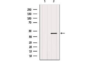 Western blot analysis of extracts from MCF7, using HSD17B2 Antibody.