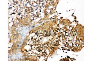Immunohistochemistry (IHC) image for anti-NLR Family, Pyrin Domain Containing 3 (NLRP3) (AA 12-31), (N-Term) antibody (ABIN3044250)
