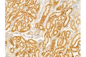 anti-Sulfatase 1 (SULF1) (Internal Region) antibody