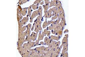 IHC analysis of ATP5F1B using anti-ATP5F1B antibody (ABIN7599866). (Atp5f1b (AA 123-529) Antikörper)