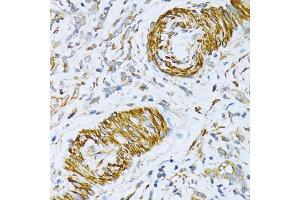 Immunohistochemistry (IHC) image for anti-Vesicle-Associated Membrane Protein 1 (Synaptobrevin 1) (VAMP1) (AA 1-96) antibody (ABIN6150046)
