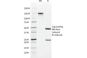SDS-PAGE Analysis Purified Cytokeratin 18 Mouse Monoclonal Antibody (DC10). (Cytokeratin 18 Antikörper)