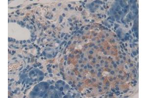 DAB staining on IHC-P; Samples: Rat Pancreas Tissue (IGF2R Antikörper  (AA 1146-1363))
