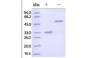 Human IgG2 Fc, Tag Free on SDS-PAGE under reducing (R) and no-reducing (NR) conditions.