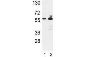 Western blot analysis of G6PD antibody and 1) K562, 2) MCF-7 lysate. (Glucose-6-Phosphate Dehydrogenase Antikörper  (AA 297-326))