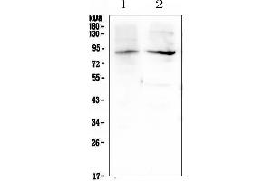 Western blot analysis of XPB using anti-XPB antibody (ABIN6719310).