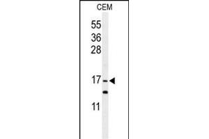 Western blot analysis of GMFG Antibody (C-term) (ABIN652407 and ABIN2841991) in CEM cell line lysates (35 μg/lane). (GMFG Antikörper  (C-Term))