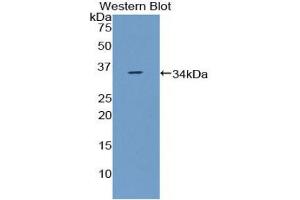 Western blot analysis of the recombinant protein. (CCDC80 Antikörper  (AA 635-906))