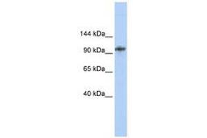 Image no. 1 for anti-Bobby Sox Homolog (BBX) (AA 720-769) antibody (ABIN6740329) (BBX Antikörper  (AA 720-769))