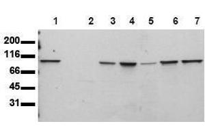 Western Blotting (WB) image for anti-Signal Transducer and Activator of Transcription 6, Interleukin-4 Induced (STAT6) antibody (ABIN126902) (STAT6 Antikörper)