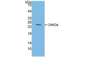 Western Blotting (WB) image for anti-Insulin-Like Growth Factor Binding Protein 2, 36kDa (IGFBP2) (AA 148-325) antibody (ABIN7430594)