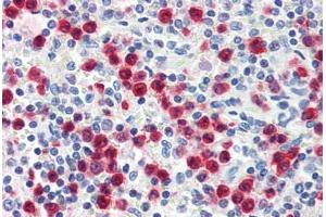Human Spleen, Granulocytes (formalin-fixed, paraffin-embedded) stained with S100A8 antibody ABIN334255 at 1:50 followed by biotinylated anti-mouse IgG secondary antibody ABIN481714, alkaline phosphatase-streptavidin and chromogen. (S100A8 Antikörper  (FITC))